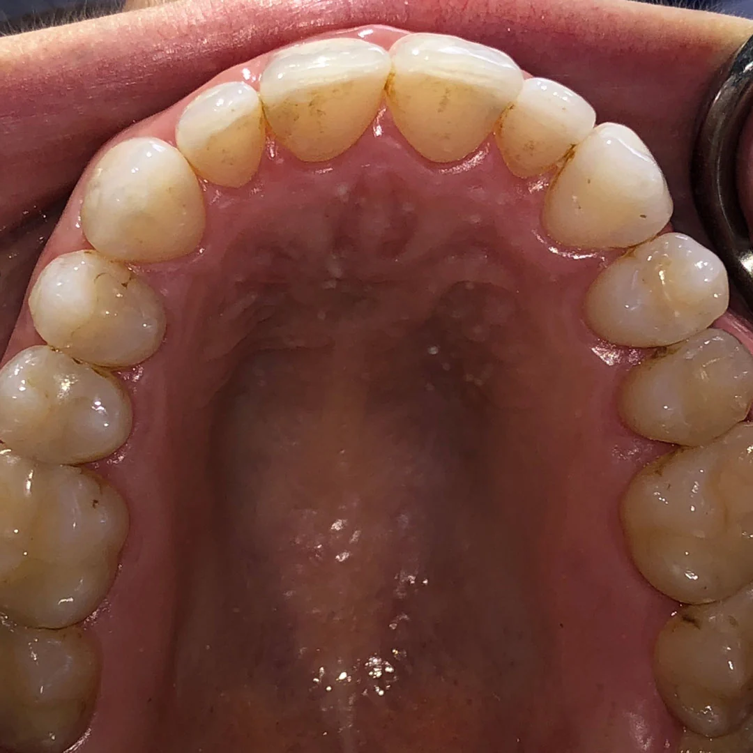 After image