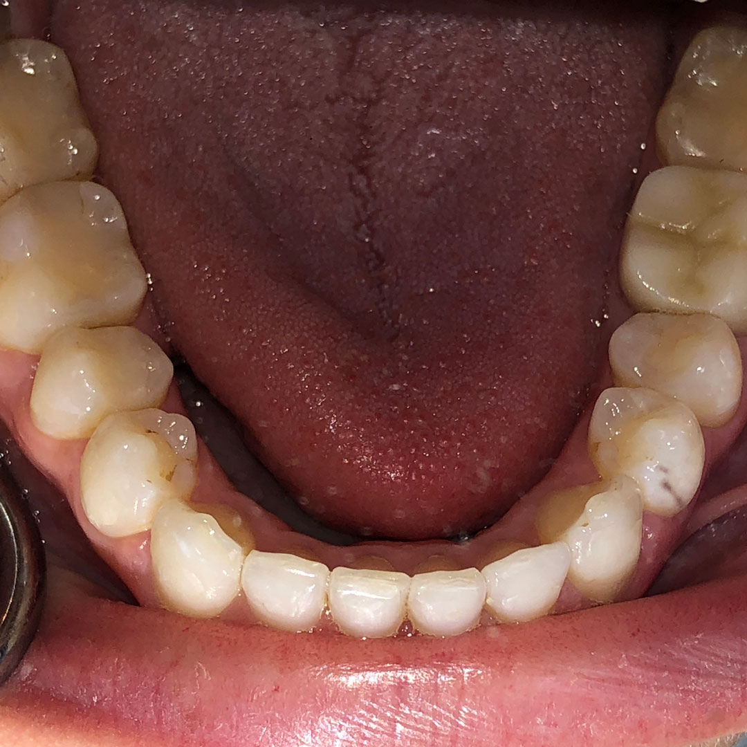 After image
