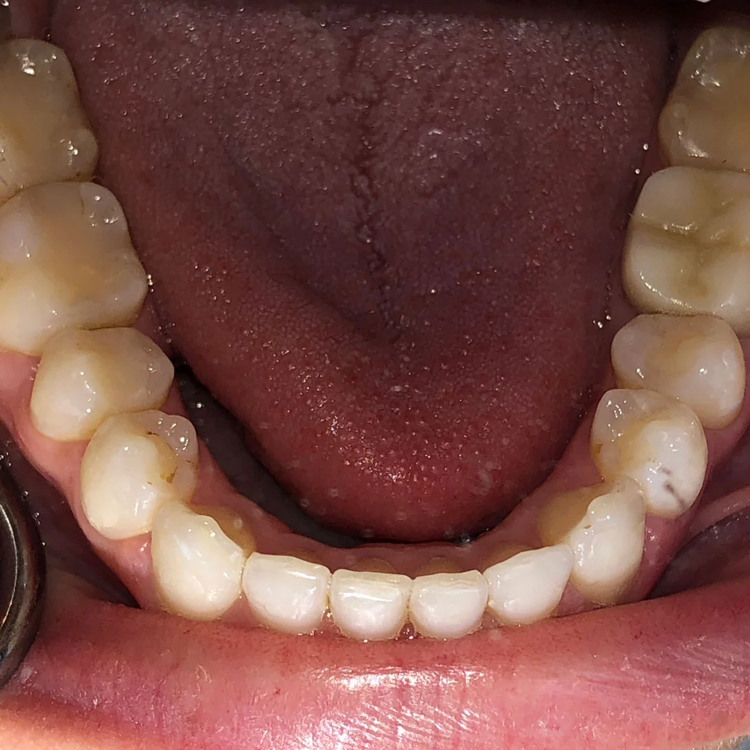 After image