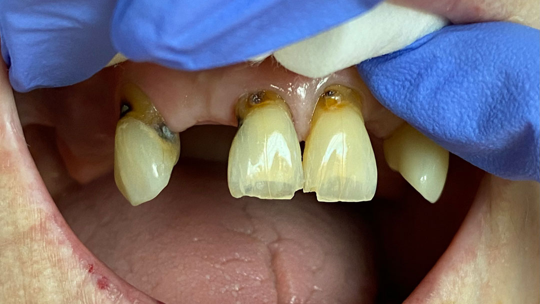 Before image