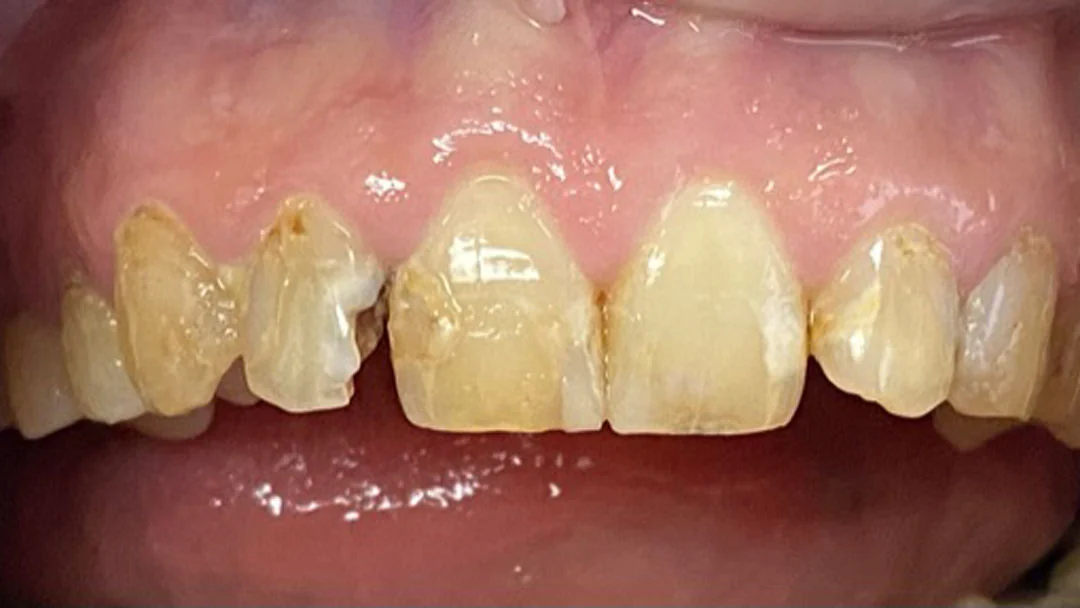Before image