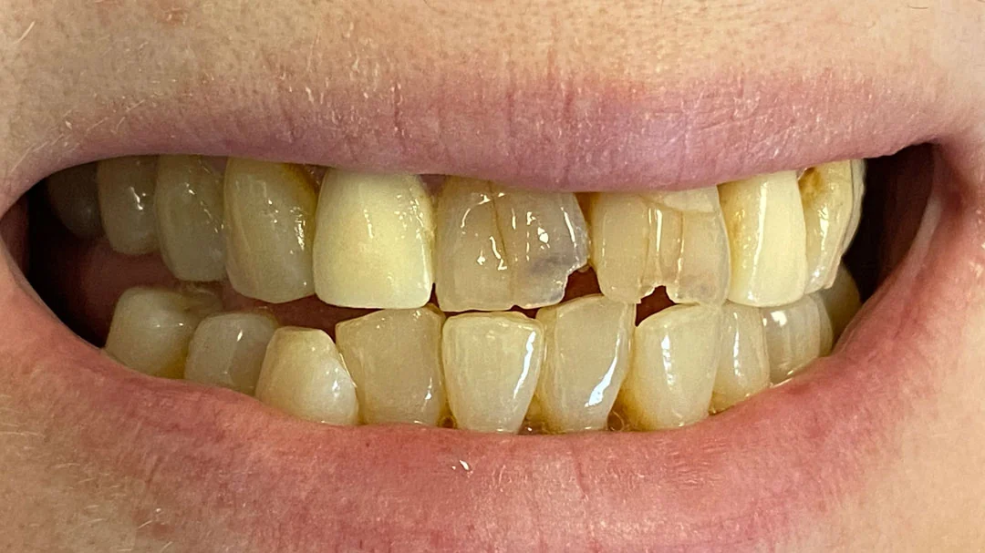 Before image