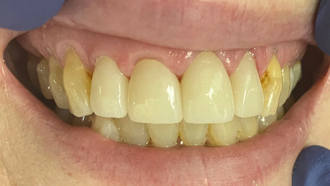 After image