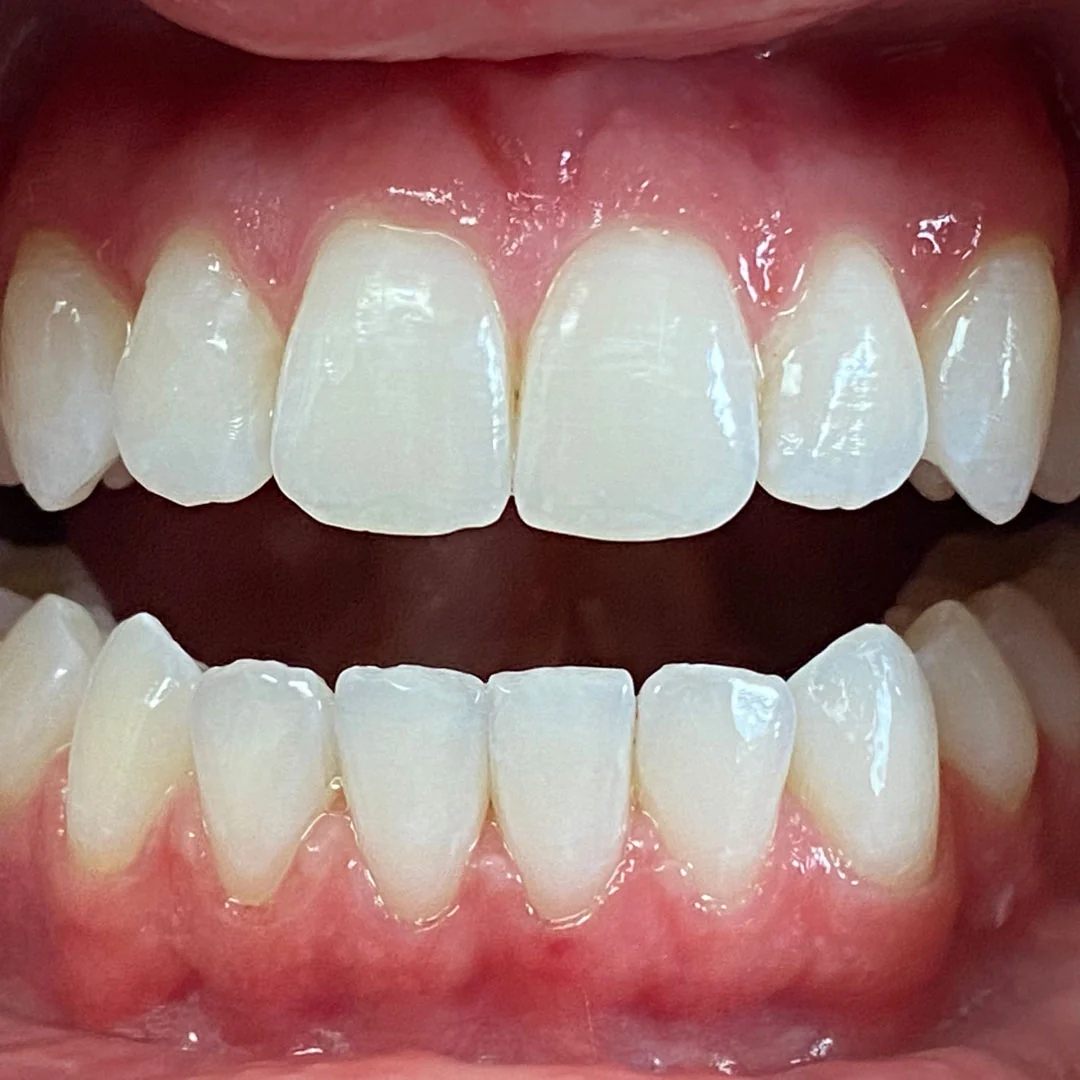 After image