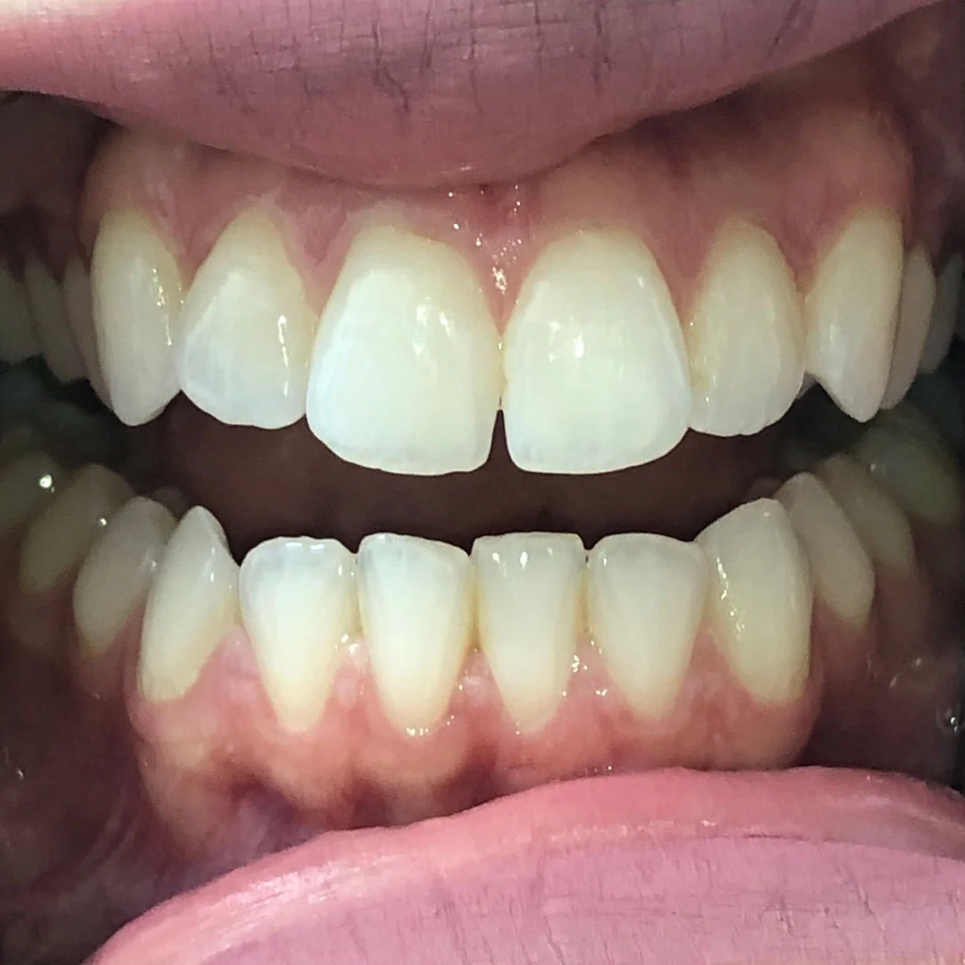 Before image
