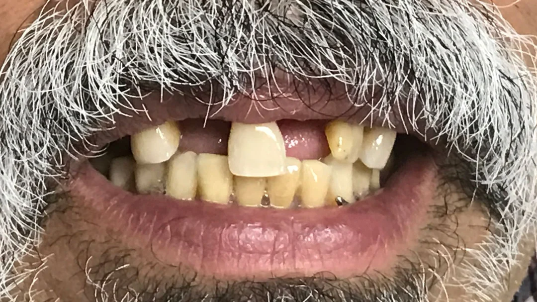 Before image
