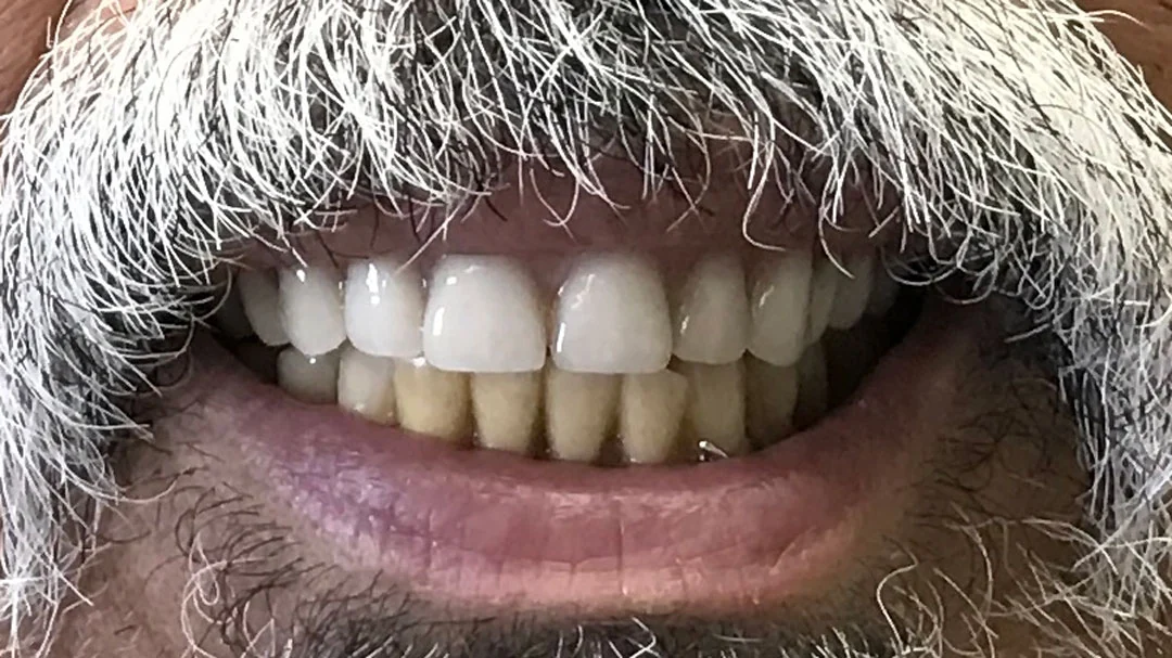 After image