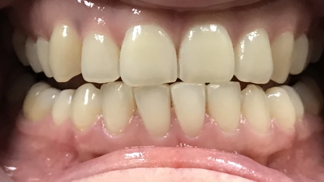 Before image
