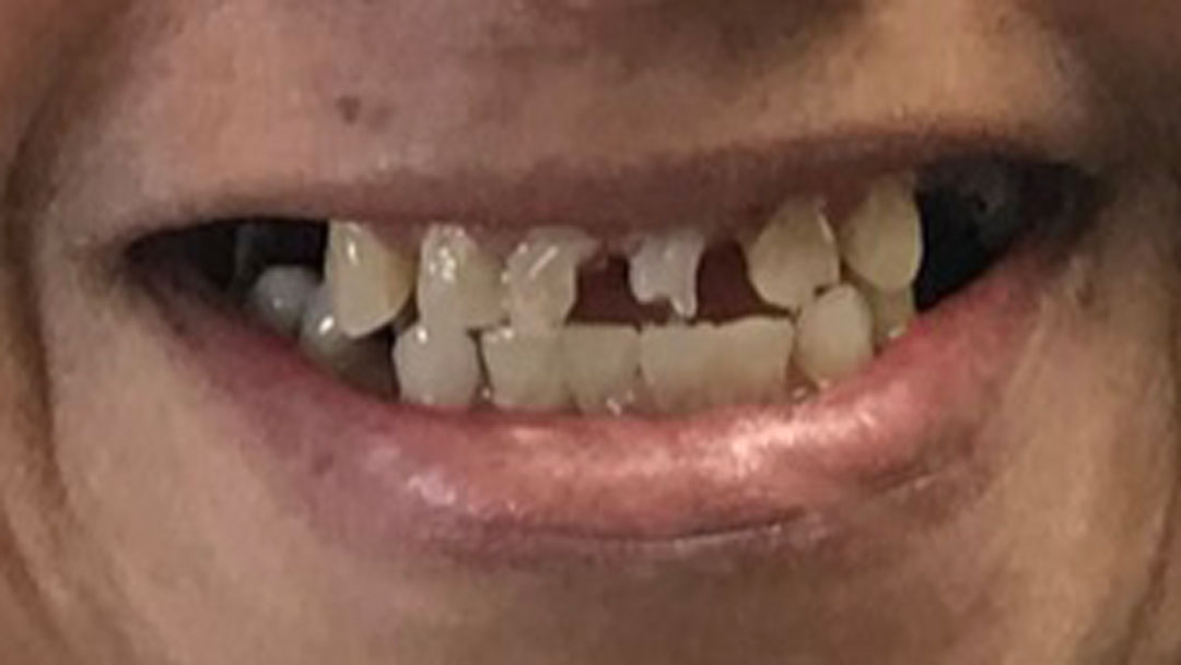 Before image