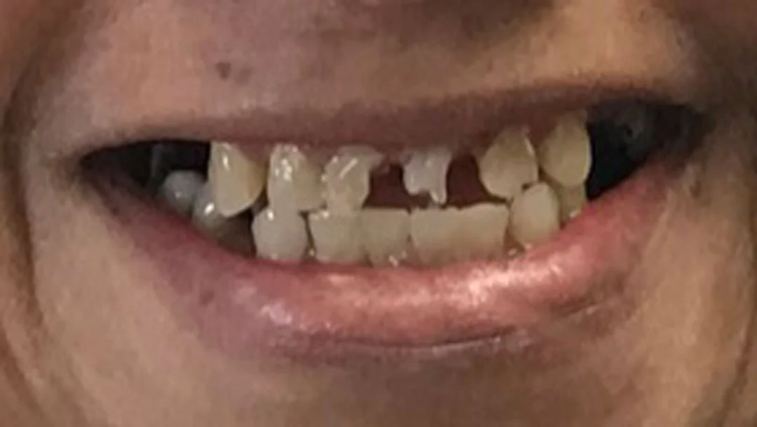 Before image