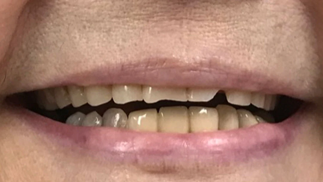 Before image