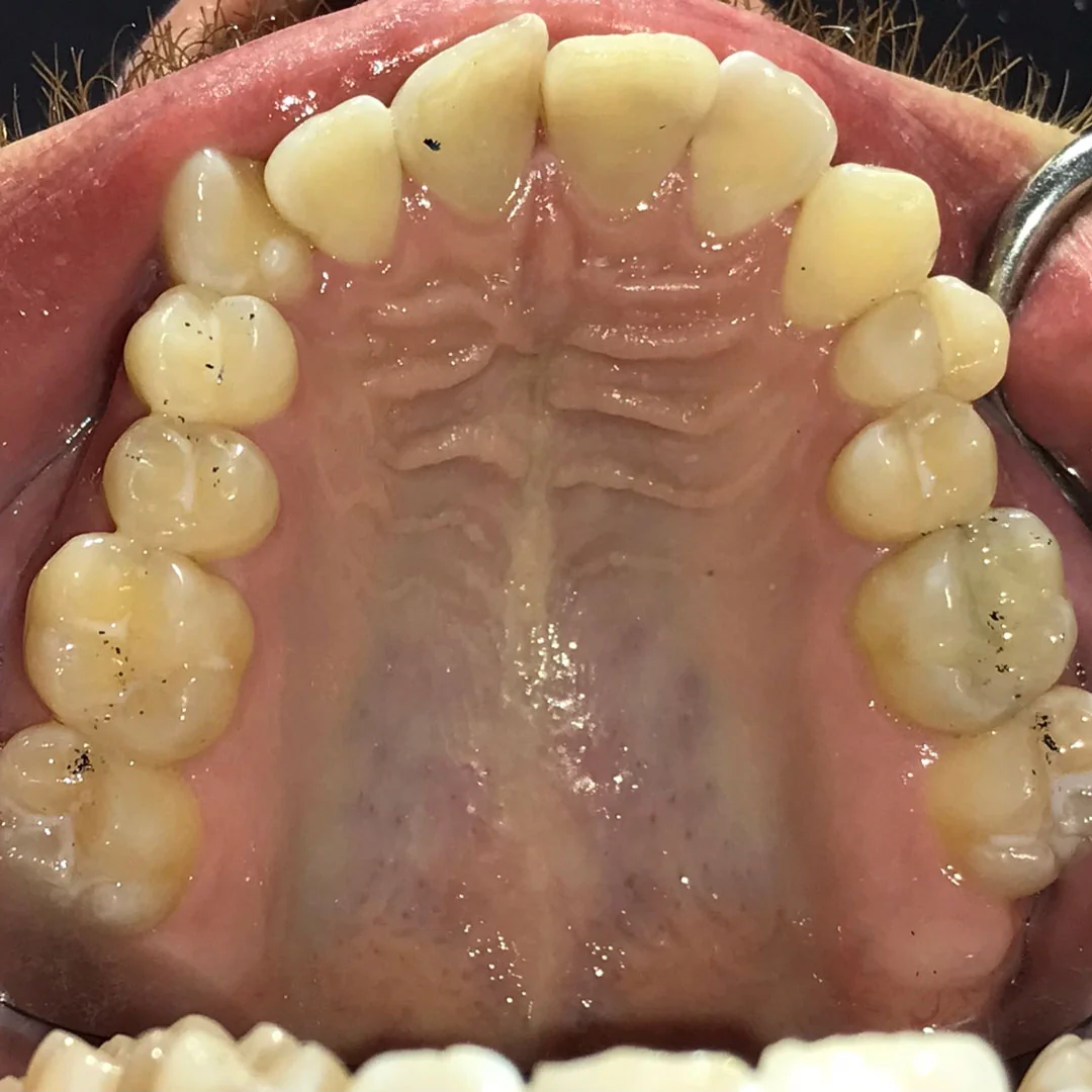 Before image