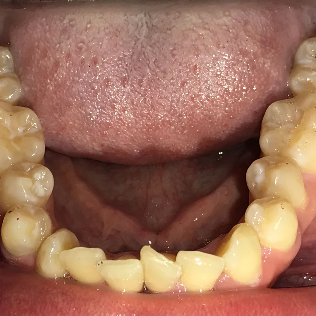 Before image