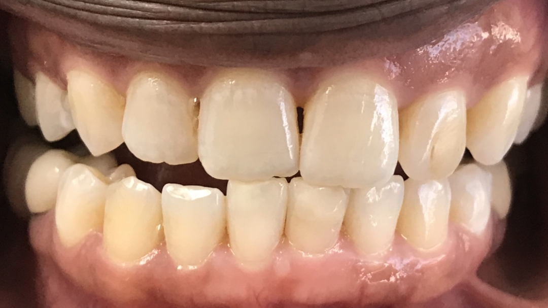 Before image