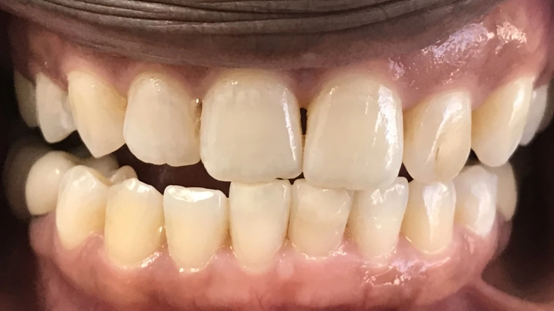 Before image