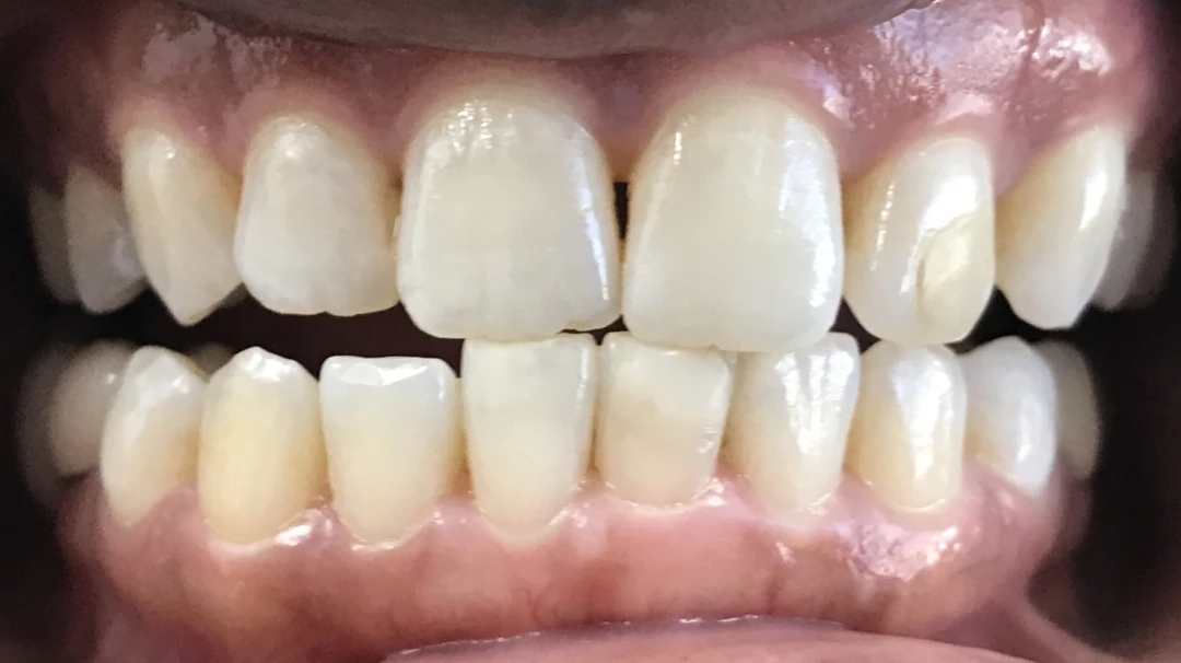 After image