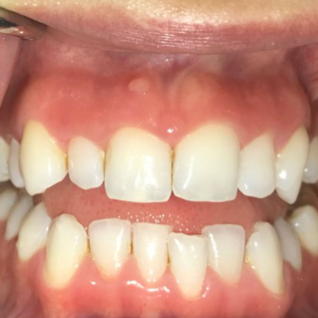 Before image