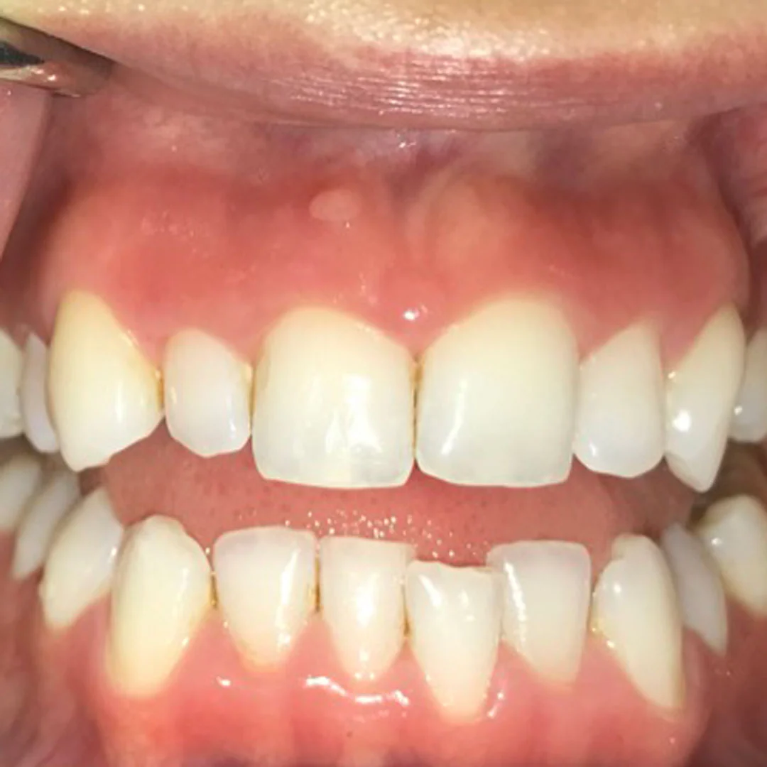 Before image