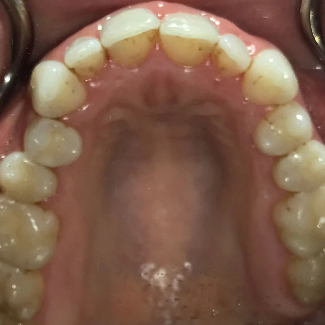 Before image