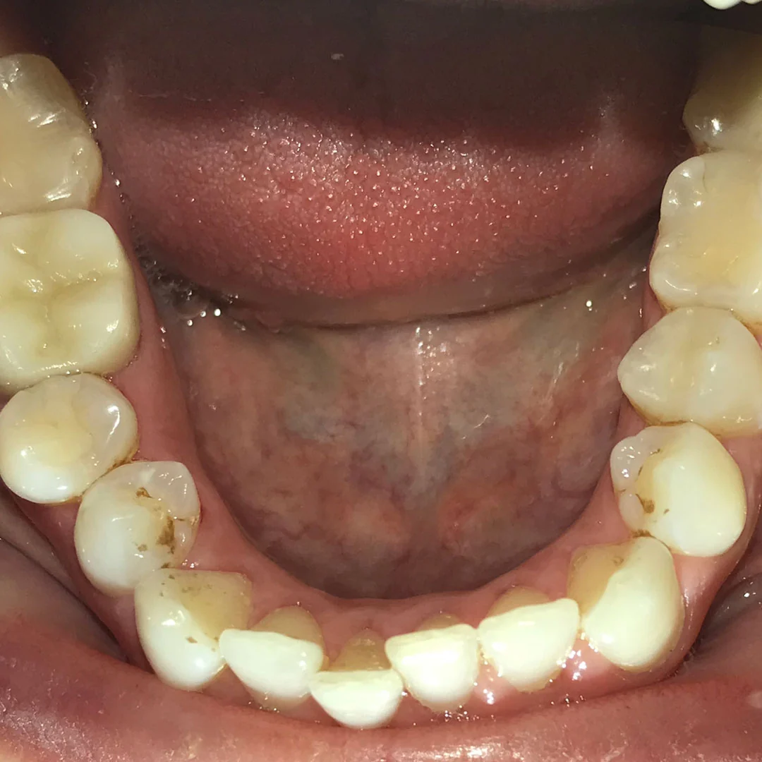 Before image