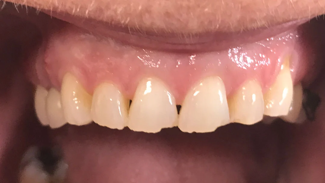 Before image