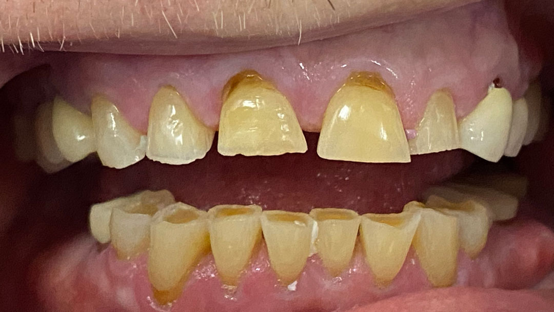 Before image