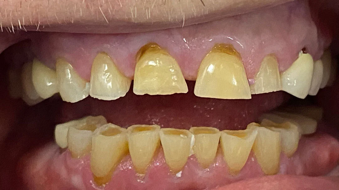 Before image