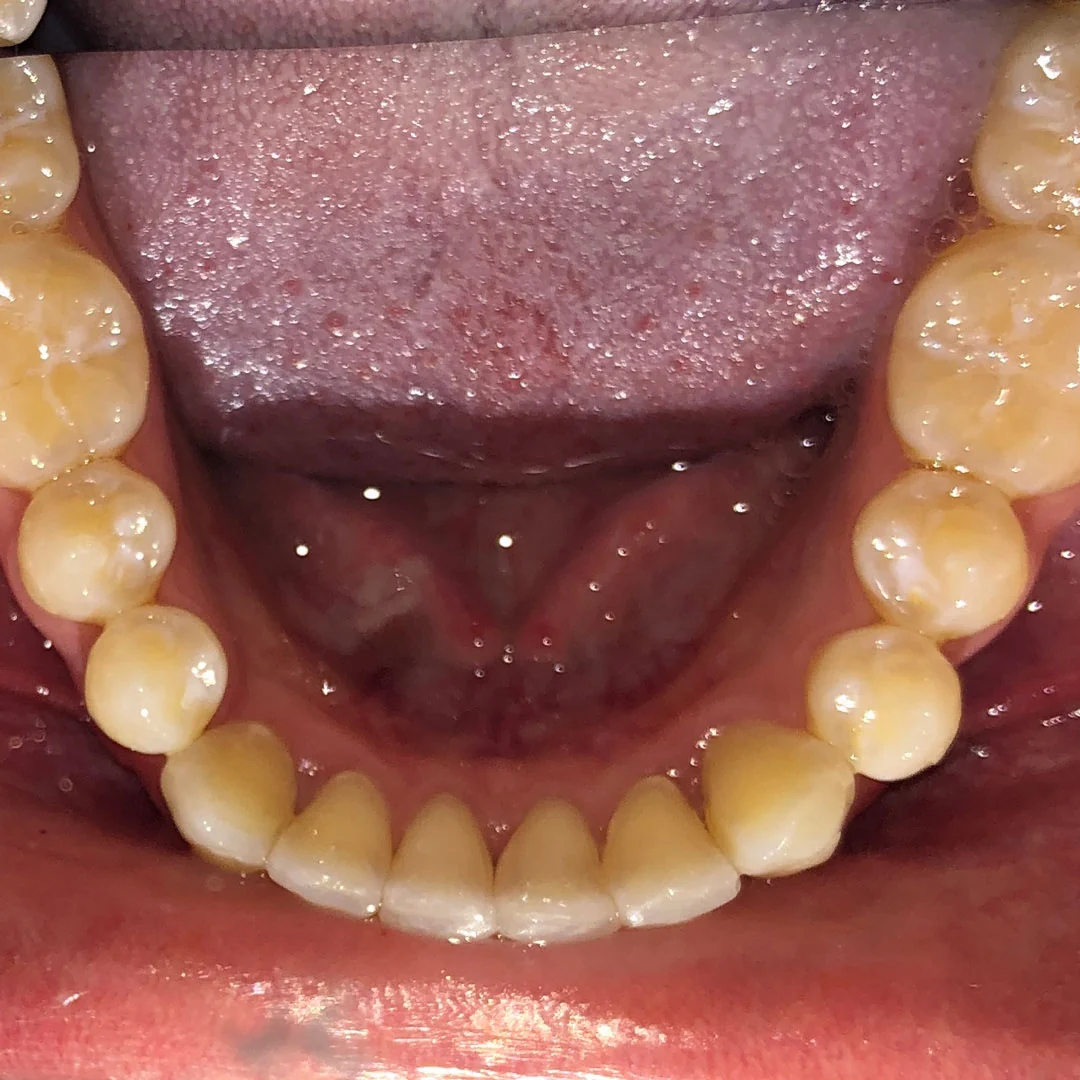 After image