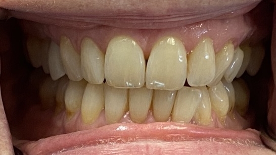 Before image