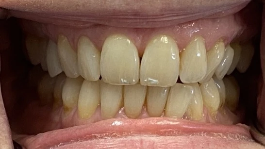 Before image