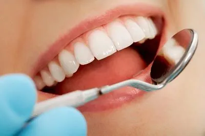 closeup of a woman's smile after periodontal treatment