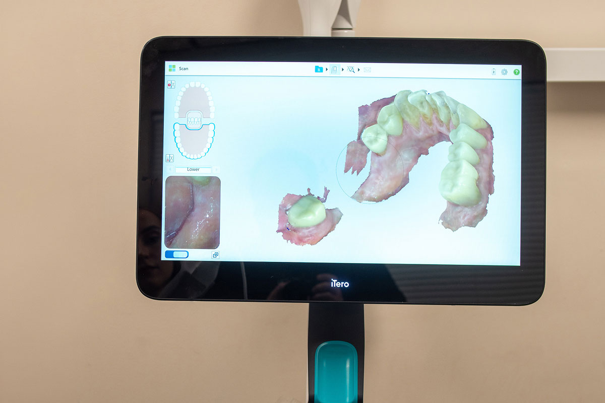 Cosmetic dentistry at Park Ridge Smile Center in Park Ridge, IL